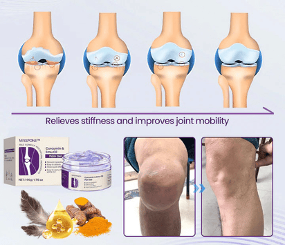 Misspone™ Curcumin & Emu Oil Pain Gel - Backed by US Osteopathic Experts - Avolen