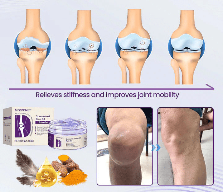 Misspone™ Curcumin & Emu Oil Pain Gel - Backed by US Osteopathic Experts - Avolen